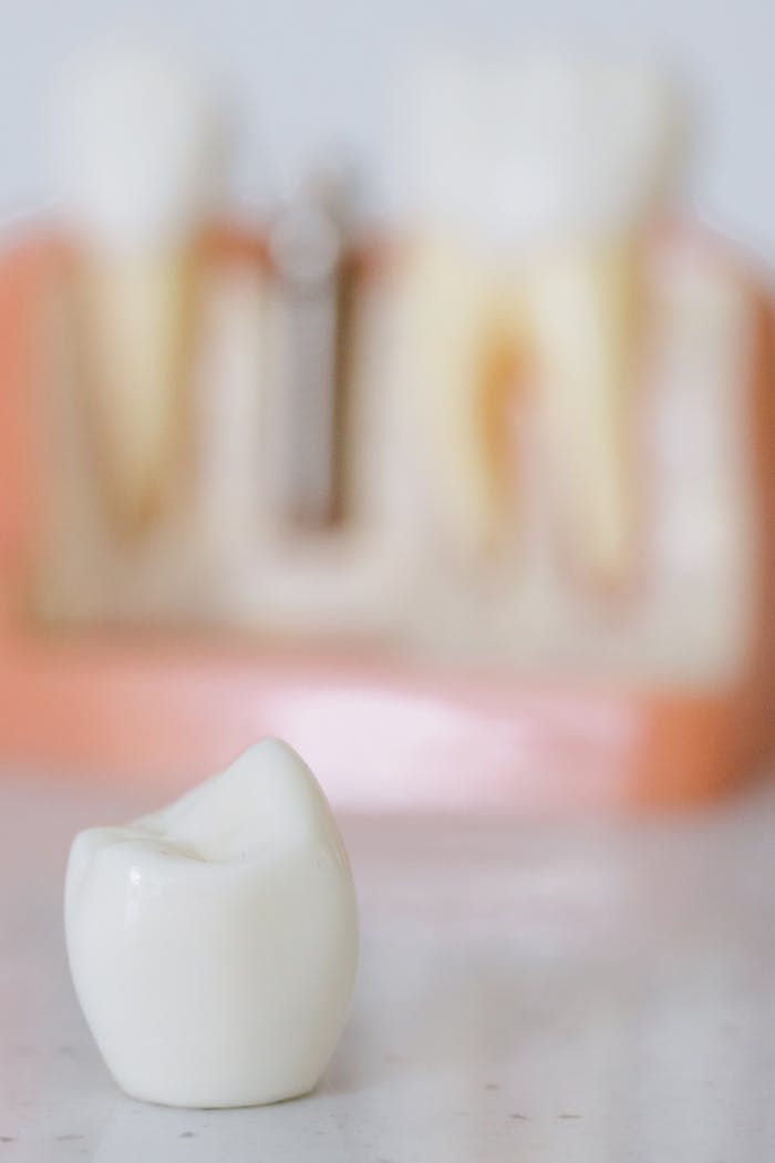 impact-img Detailed close-up of a dental prosthetic with a sterilized and blurred dental model background.
